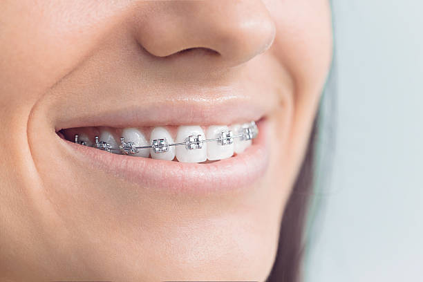 Why Choose Us for Your Dental Needs in Northwest Ithaca, NY